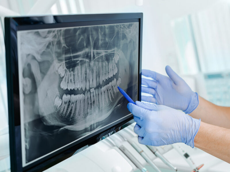 The Benefits of Dental Monitoring