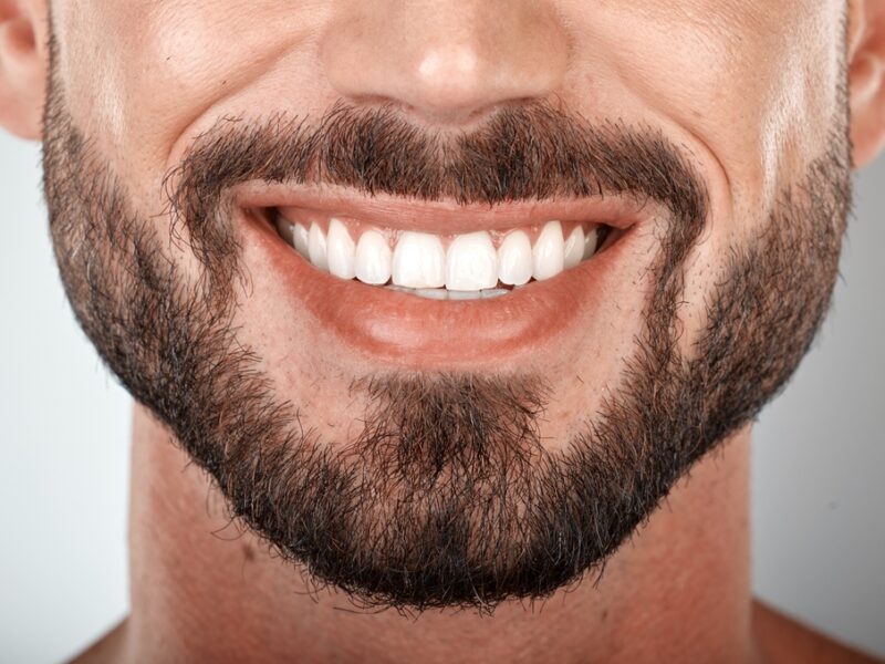 How to Achieve a Winning Smile with Scale and Polish Treatments