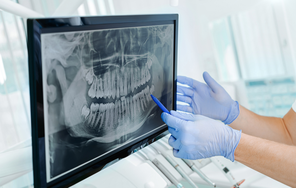 Why Dental Monitoring is Important